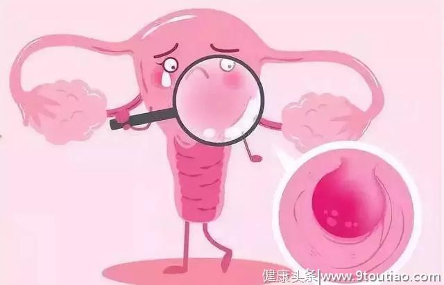 中医治疗女性子宫肌瘤：破瘀和破寒