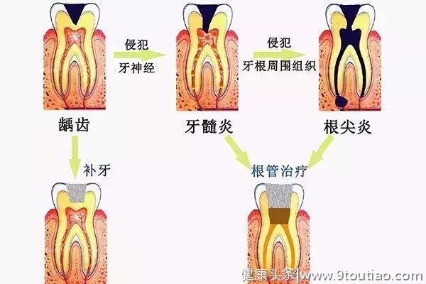 每年都要做的【口腔检查】到底是检查什么？