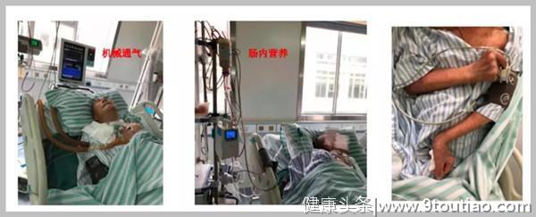 “医生，别救我了，请让我死吧。”