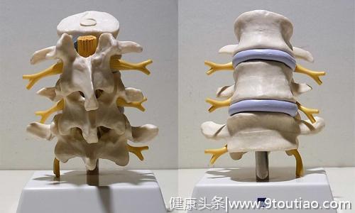骨科医生：怎么预防骨质增生引起的腰腿疼痛？