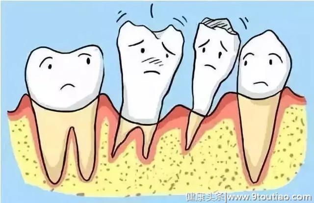牙齿的隐形杀手：不能根治的牙周病！