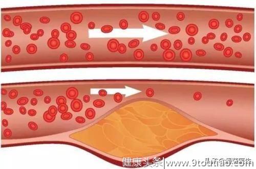 如何解读黑木耳的食疗价值？