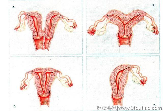 双子宫女性怀孕，将经历什么？江西的“双子宫妈妈”创造了奇迹