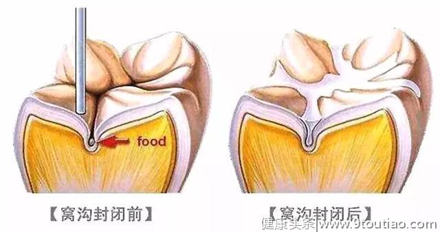 坚持这么做，人人都能预防和远离口腔疾病