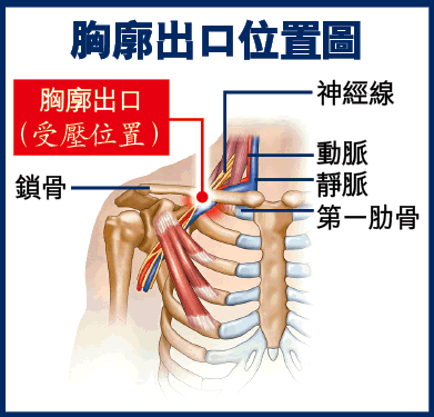 专家级科普，引起“颈椎疼痛”的原因有哪些，您知道吗？