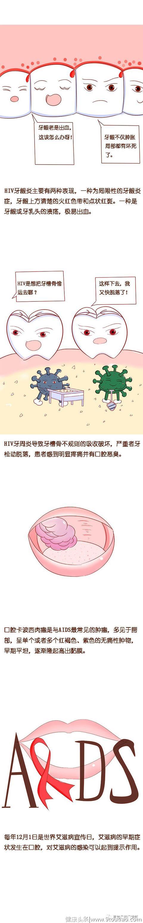 罗兰口腔漫画科普艾滋病的口腔表征