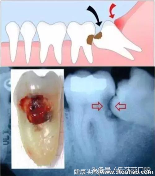 做了半辈子牙医可能都没见过的牙齿情况！