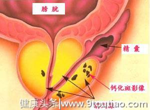 前列腺，是哪个“县”？其实他很重要，只不过大家没留心！