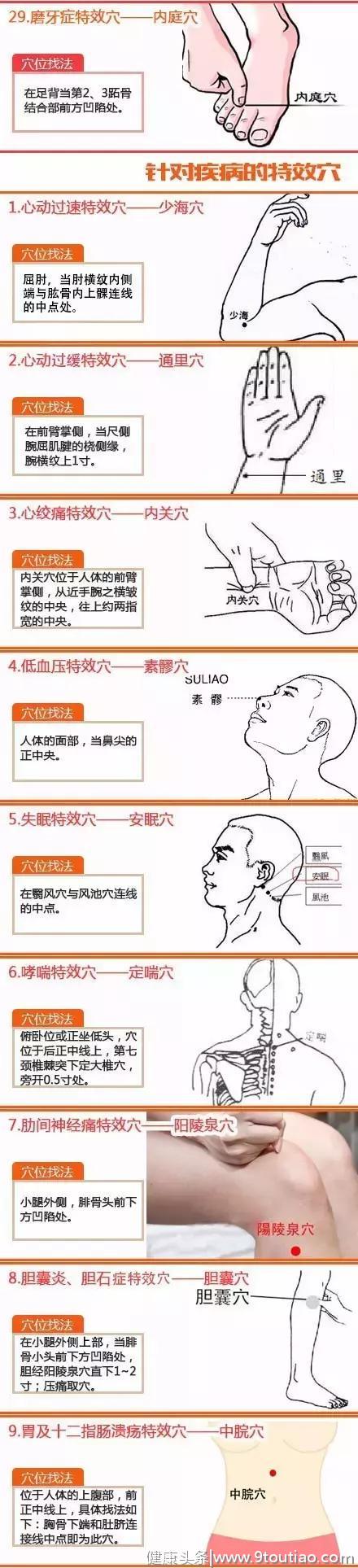 看图学习！针灸特效穴汇总（纯干货）