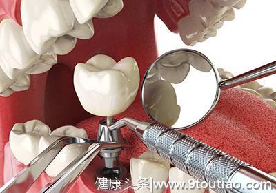 四大理由告诉你为什么牙齿缺失之后一定要选择种植牙！