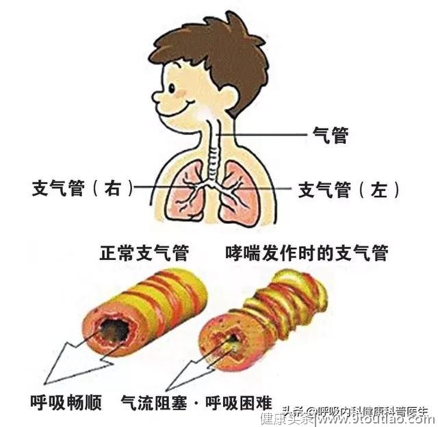 电视剧《都挺好》后续：待到山花烂漫时，“哮喘”丛中哮