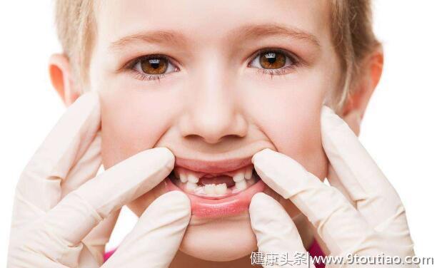 儿童牙医詹磊：儿童牙齿烂掉只剩牙根怎么处理？