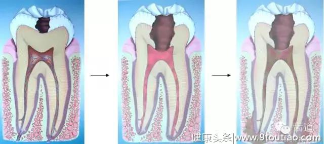 儿童口腔保健知识