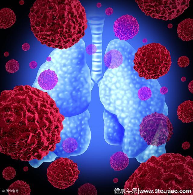 确诊为ALK阳性肺癌，可用毒性小、成效高的标靶药物，对付癌细胞