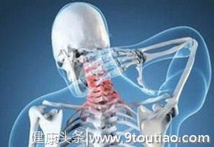肩部沉重 手臂无力 可能是神经根型颈椎病！