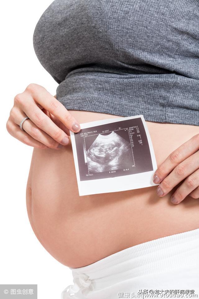 怀孕发现脂肪肝是小事？这种叫做AFLP的疾病可能需要中止妊娠