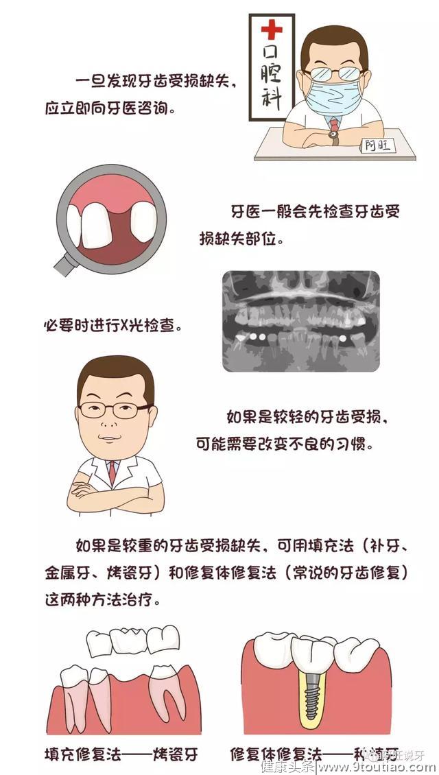 口腔常识手册之——牙齿缺失