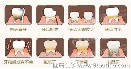 揭秘牙科暴利：十几块的牙贴面，凭啥医院要叫价千元一片？