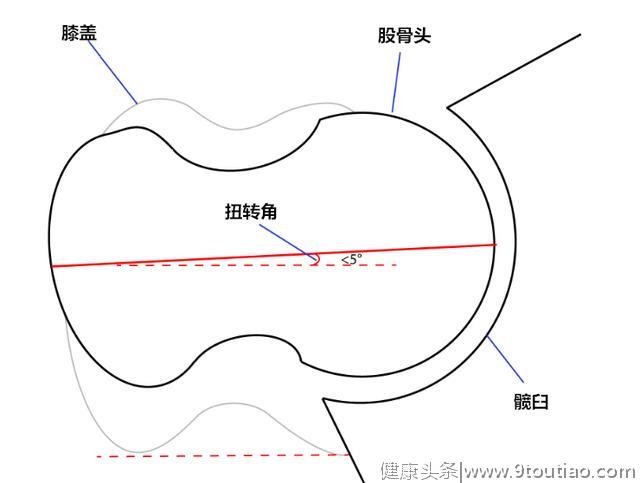 干货│如何正确找到完美的深蹲站距？