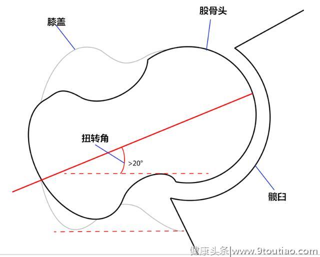 干货│如何正确找到完美的深蹲站距？