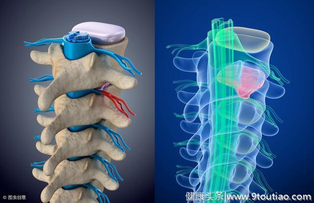 还在为肩颈疼痛困扰吗？专家提示：这五个办法拯救你的颈椎