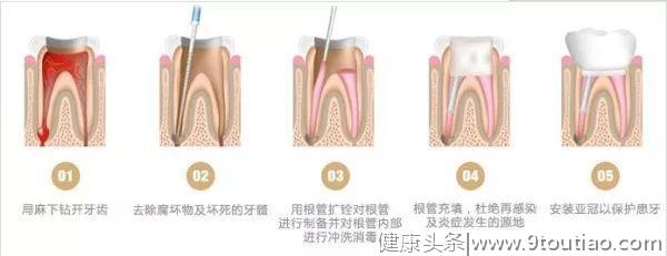 牙齿变黑，可能和蛀牙没半点儿关系