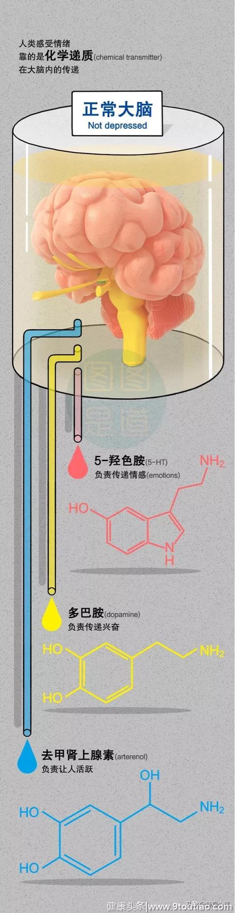 我不是不开心，是抑郁......