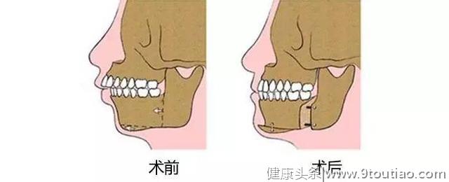 春招——19届应届生的最后一根稻草，和口腔健康有关！