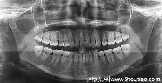 我老婆怀孕的时候牙疼了，到底要不要看医生？