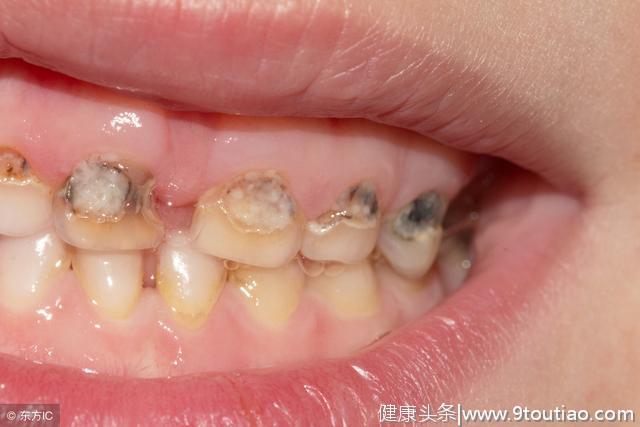 导致牙疼的七大根源性问题被找出，你反复牙疼就是它害的！