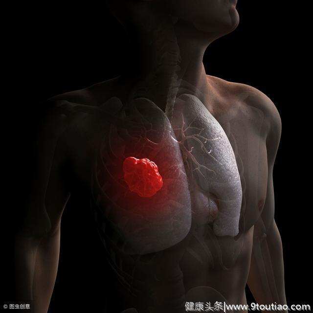 经常胸闷、胸痛或是早期肺癌征兆，除了吸烟肺癌可能是“气”出来