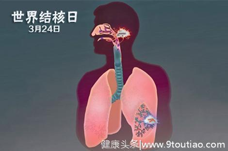 哮喘等肺部疾病可能与巨噬细胞有关，通过这方法可能改善治疗！