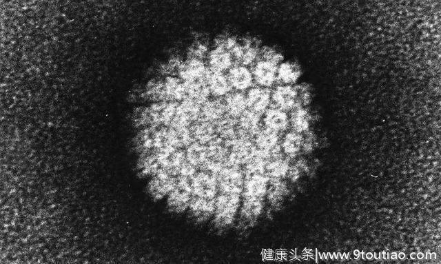 抗癌药物可能有助于治疗人乳头瘤病毒感染