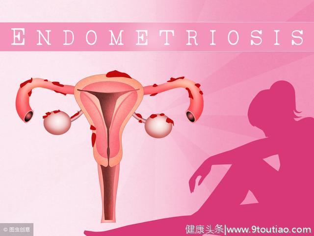 子宫脱垂2个症状别忽视，子宫脱垂危害有几点