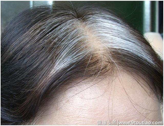 花椒水泡脚能促进血液循环，达到养生效果，还能治白头发？