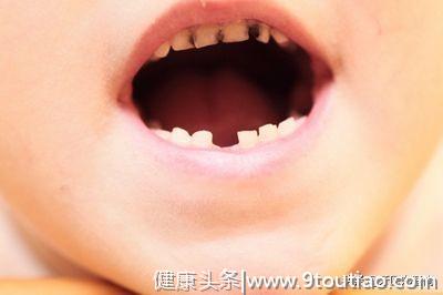 孩子多久检查一次牙齿好？