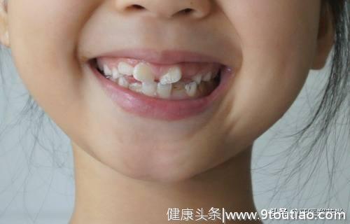 孩子多久检查一次牙齿好？