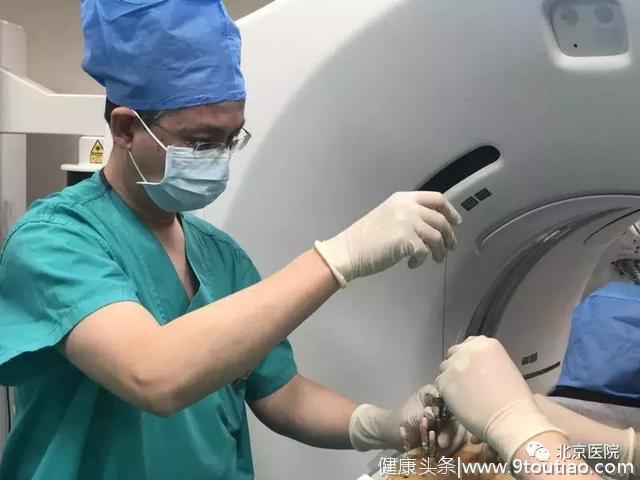 又是首次！北京医院肿瘤微创治疗中心采用先进技术治疗胰腺癌