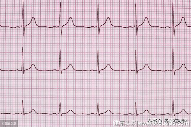 耳垂上有“沟”代表患有冠心病？医生建议这3个检测才准确