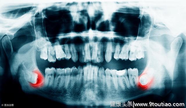 牙龈炎导致牙龈出血、萎缩？牙医：5个小妙招让你拥有健康牙龈