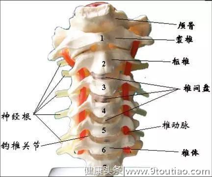 什么是神经根型颈椎病？要怎样预防