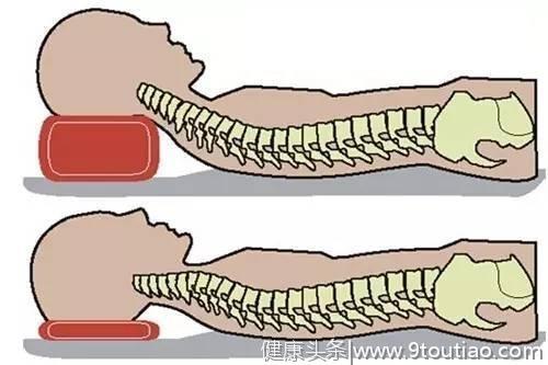 颈椎病患者用什么样的枕头好？