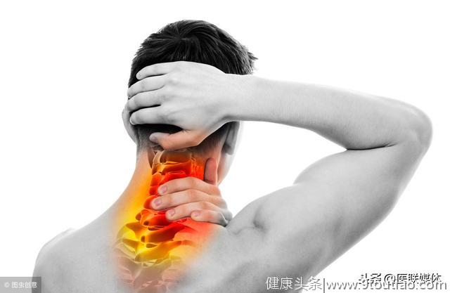 颈肩痛就是颈椎病？医生：颈椎病主要有2种类型，表现不一