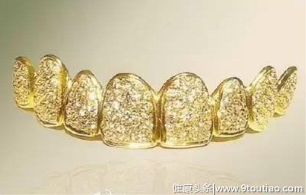 世界牙科趣闻：黄金和钻石打造假牙！