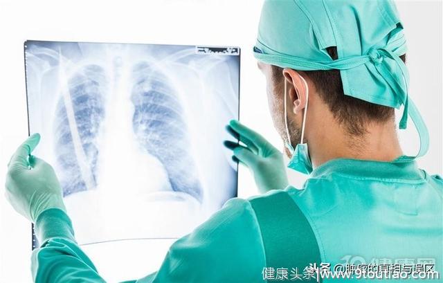 肺癌已成中国第1癌！医生直言：这5种人，最讨肺癌“喜欢”