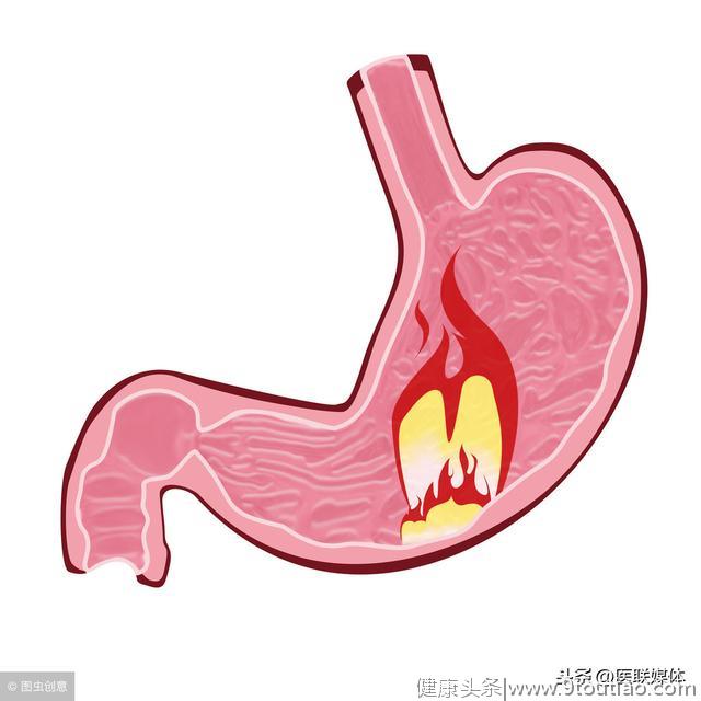 胃炎是如何转化为胃癌的？有这2个病变，就要留个心眼