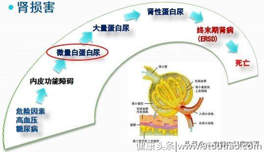 高血压病人，这件事对您很重要