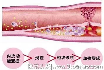 高血压病人，这件事对您很重要