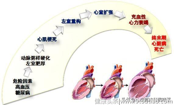 高血压病人，这件事对您很重要