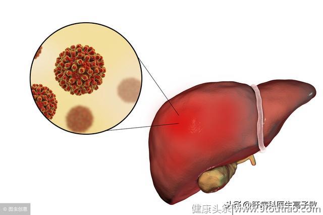 乙肝患者肝功能正常，不等于肝脏正常！